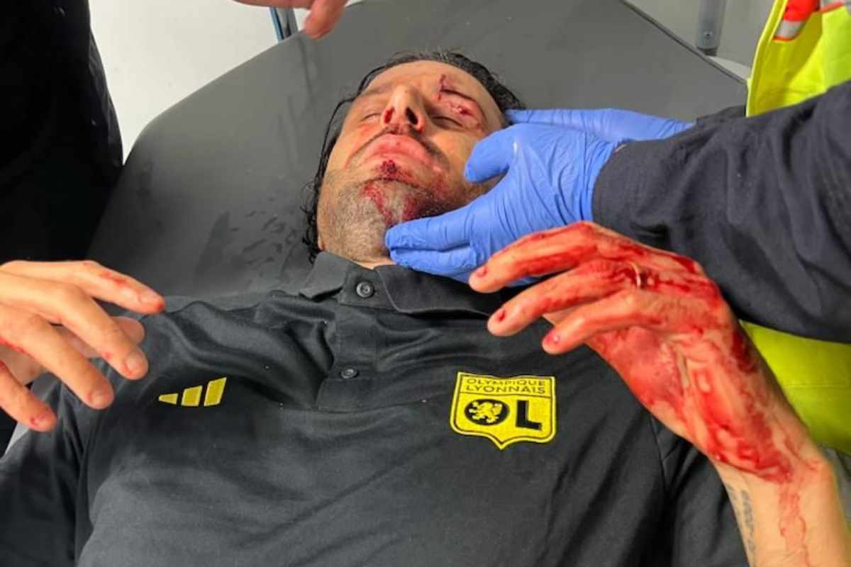 Sassate sangue tecnico italiano