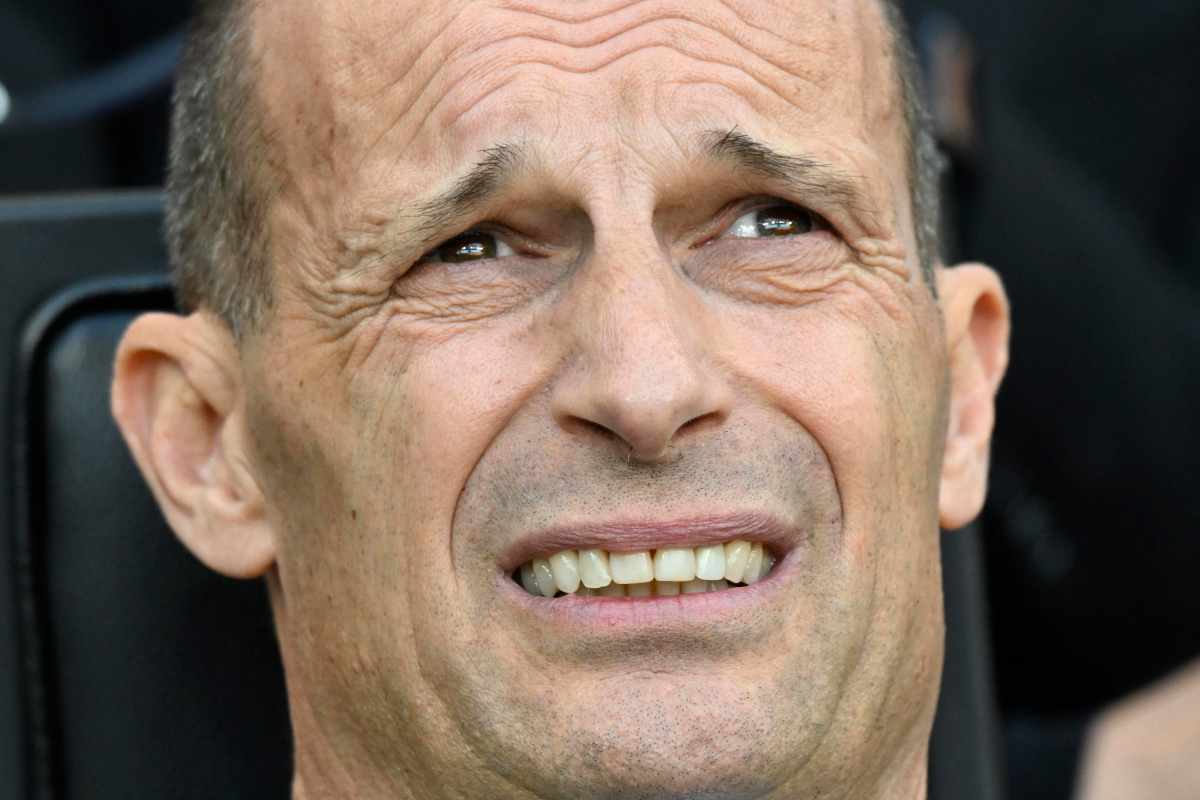 Massimiliano Allegri mentre riflette sulle scelte da fare